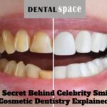 Cosmetic Dentistry Explained