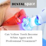 Can Yellow Teeth Become White Again with Professional Treatment?