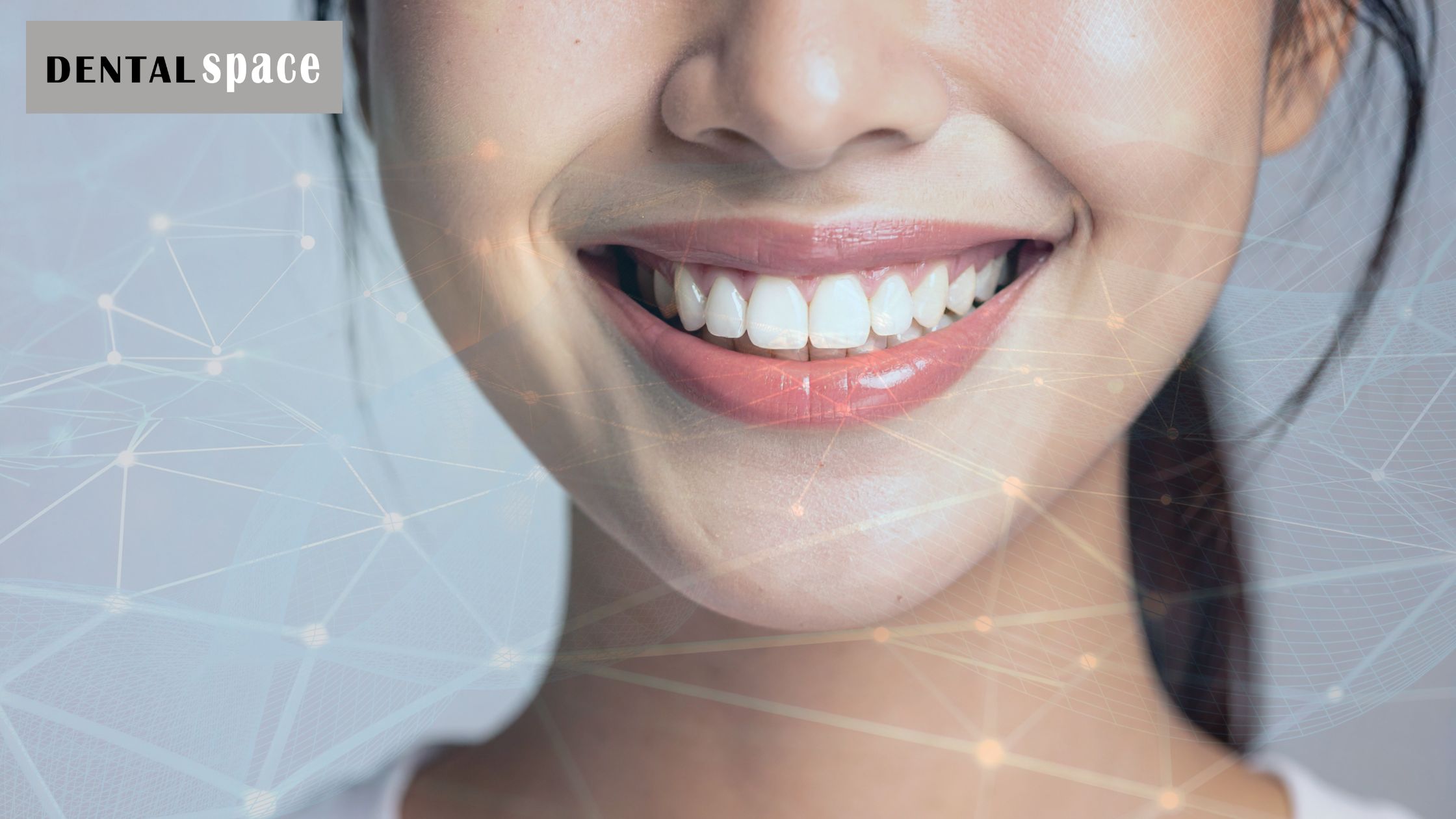 Digital Smile Design