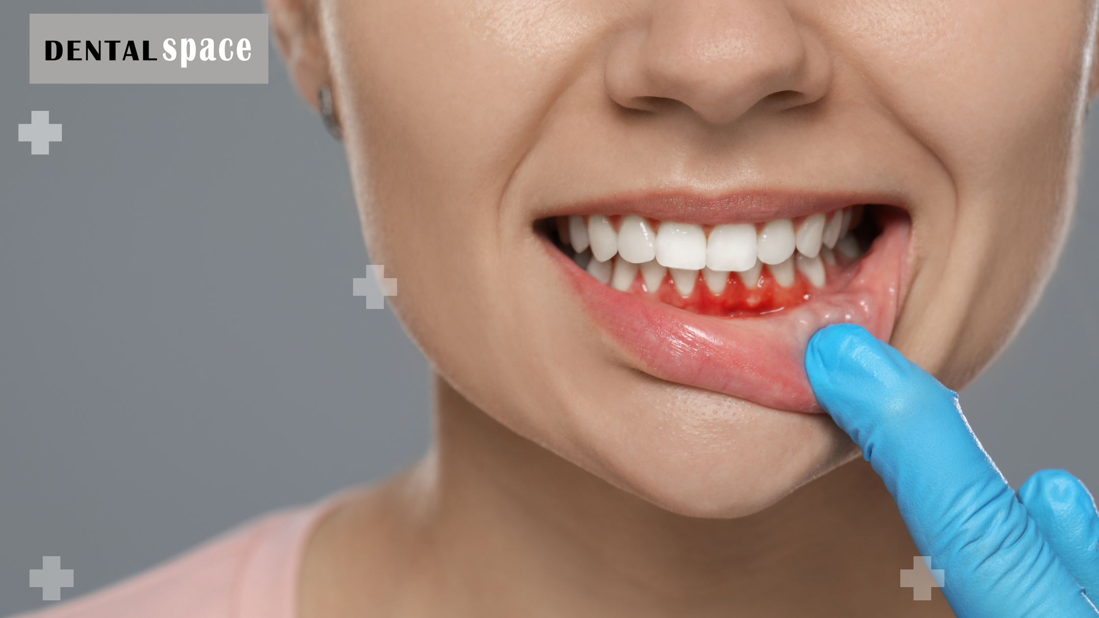 receding gums treatment