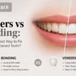 Dental Veneers vs. Bonding - Dental Space