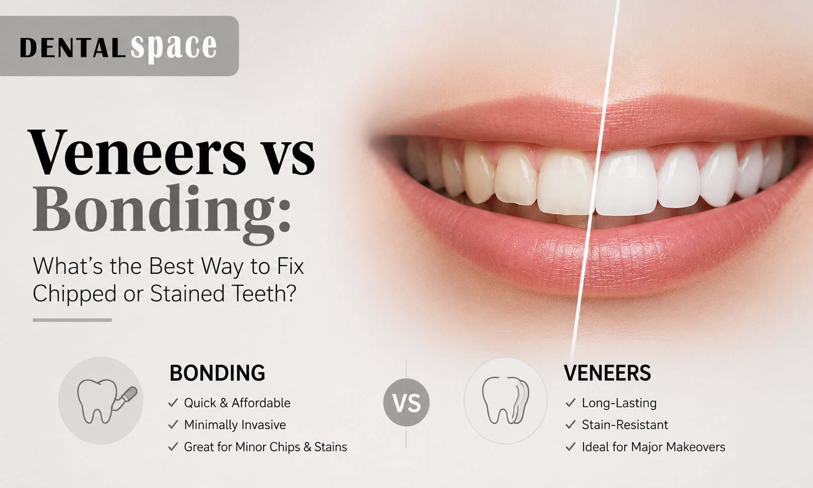 Dental Veneers vs. Bonding - Dental Space