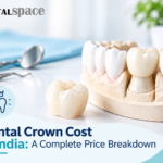 Dental crown cost in India